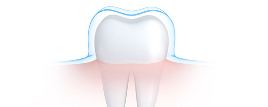 protecting-tooth-enamel-sugar-acid